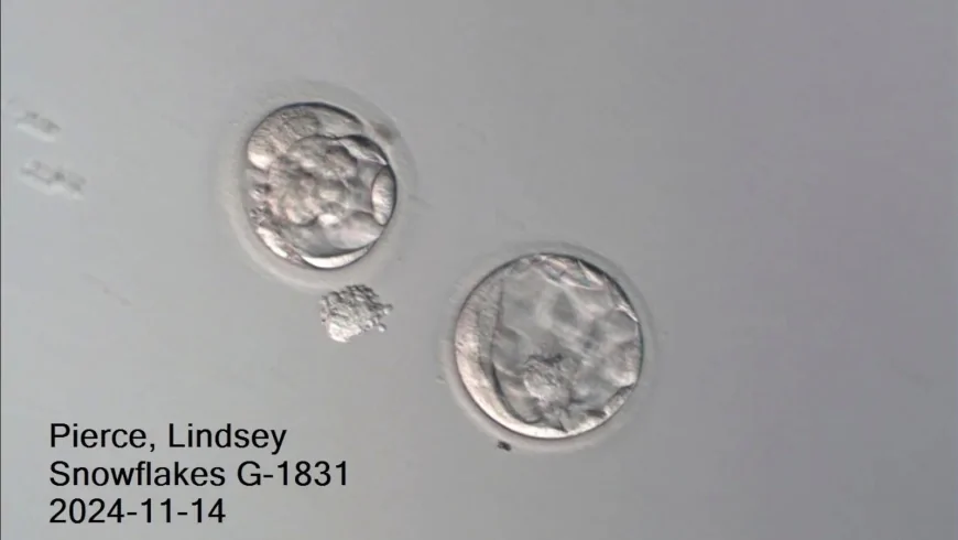 Couple welcomes a baby boy from a nearly 31-year-old frozen embryo
